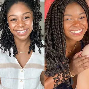 invisalign-before-after-3