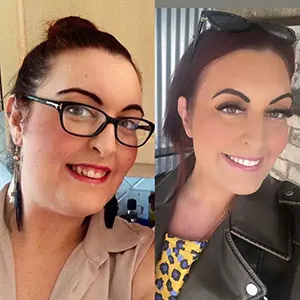 invisalign-before-after-6